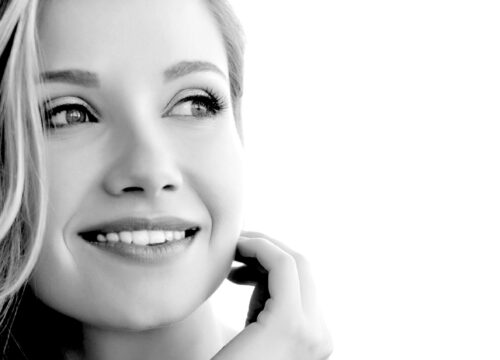 Woman with great skin after RF microneedling