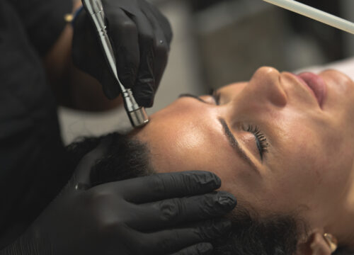 Not Ready for Surgery? The Best Non-Surgical Skin Tightening Treatments on Long Island NY