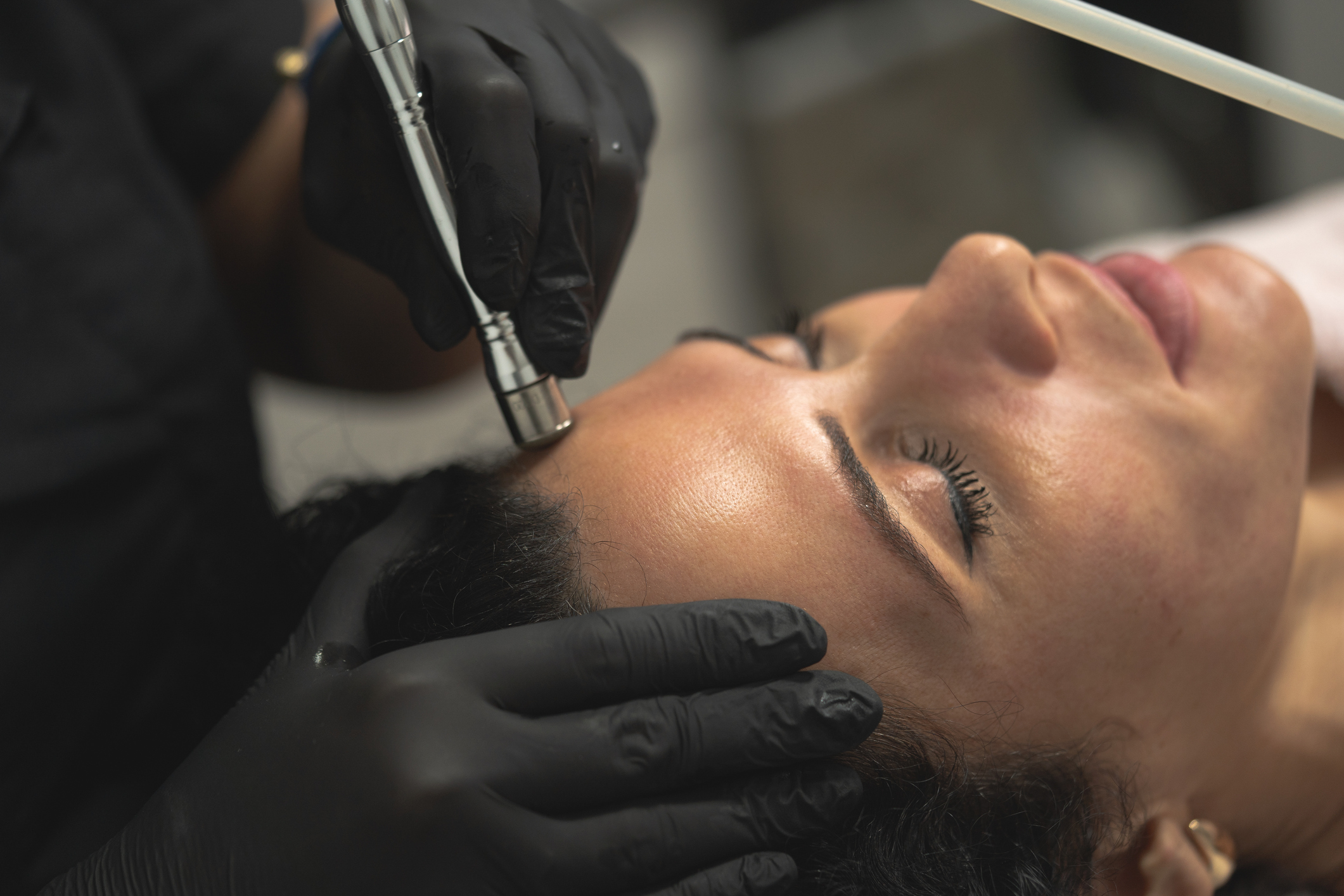 Smiling woman with great skin