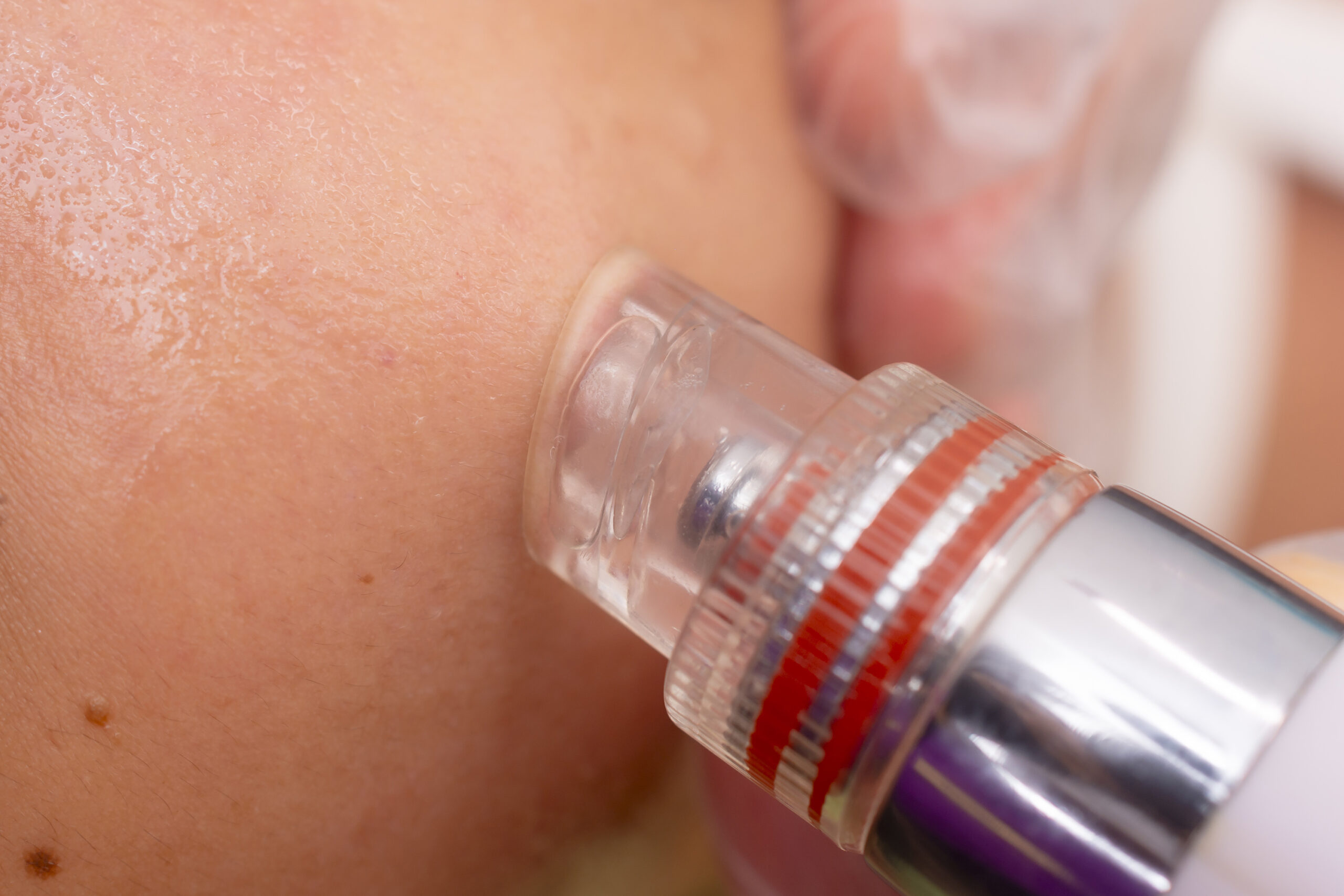 Smiling woman with great skin