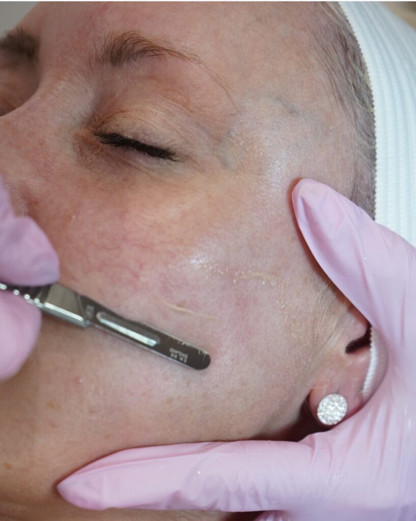 Med spa membership Lindenhurst client receiving monthly facial